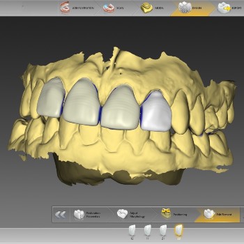 Skyzir How It Works designing