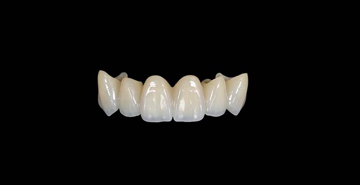 Skyzir zirconia