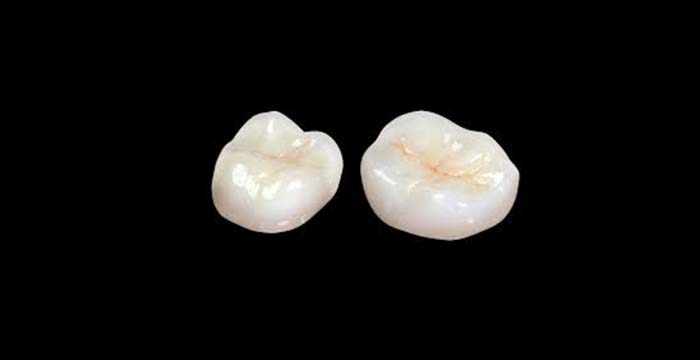 Skyzir zirconia monolith